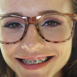 College Guys Love Braces